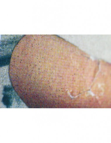 Arm
